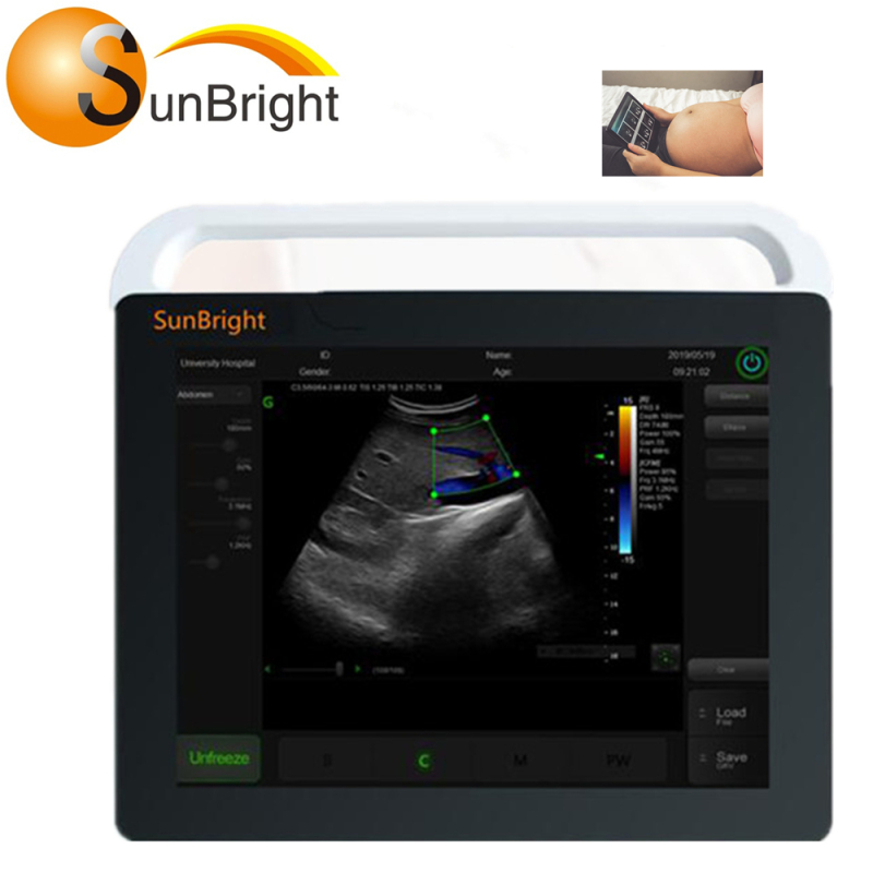 Factory supply best ultrasound machine price touch control