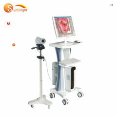 full Digital Imaging System gynecology equipment HD SONY camera digital video colposcope