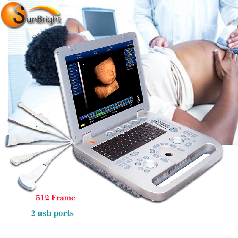 Máquina de ultrasonido médico portátil con base para PC de alto rendimiento