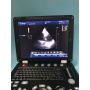 Portable cardiac color doppler ultrasound 2D 3D 4D Echocardiography Ecografos USG ecografo portatil humano