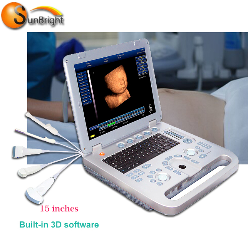 Mindray 초음파 수의학 최고 판매 노트북 3D 초음파 기계 병원 사용 휴대용 기계