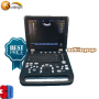 Factory price human use digital 3D ecografo USG portable ultrasonic ultrasound machine
