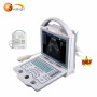 Portable LED Ultrasound Machine 2 Probe Connectors OB Pregnancy Scanner