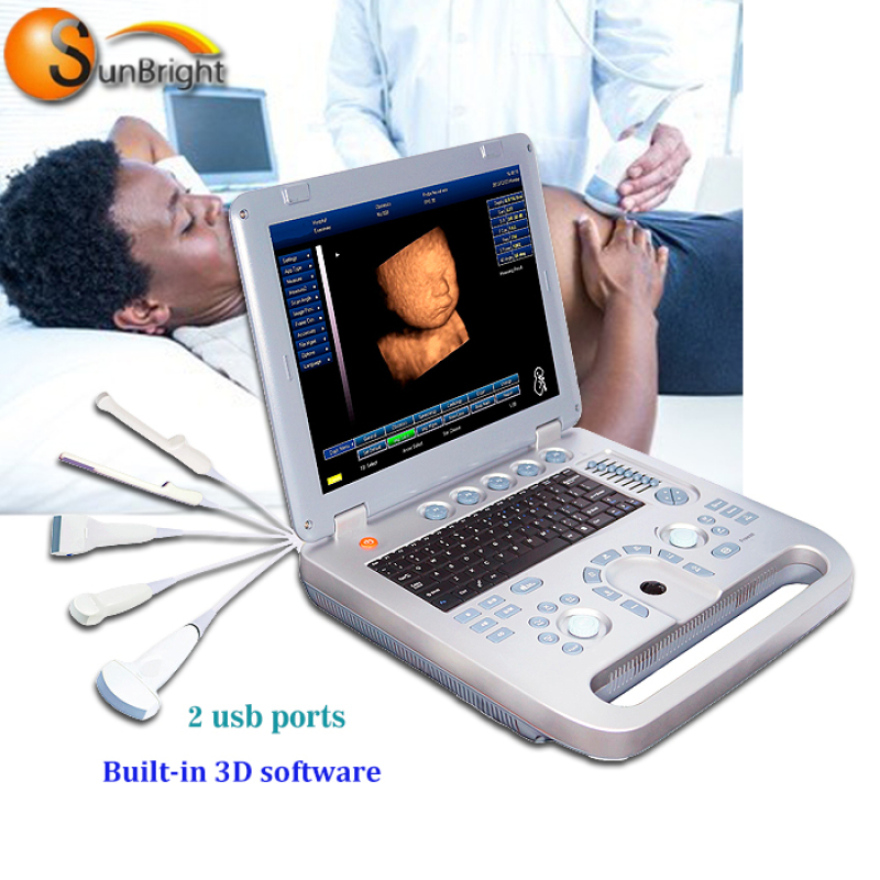 Real factory made in China laptop ultrasound device 3D echo machine for pregnancy