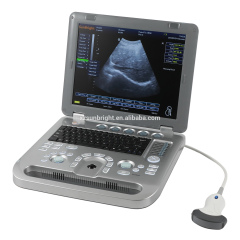 Wide range smart 2D 3D machine Cheapest price portable ultrasound scanner and applications