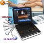 Similar to Chison Cbit 8 CE  Approved Trolley Ultrasound machine / Color doppler Ultrasound