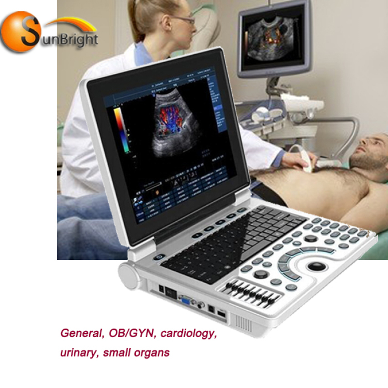 BW cheap laptop echo cardiac made in China ultrasound machine