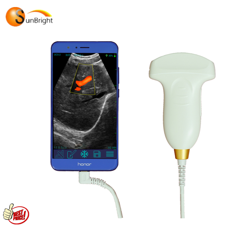 Best ultrasound machine wifi mini USB Convex probe