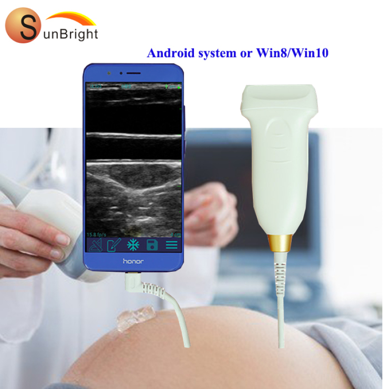 ipad iphone ultrasound probe Linear Transducer For Smart Phone
