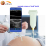 ipad iphone ultrasound probe Linear Transducer For Smart Phone