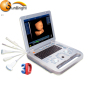 Obstetrics Gynecology Equipment 3D laptop ultrasound machine