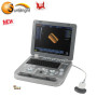 similar with medison ultrasound laptop 3D digital scanner