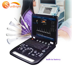 Updated medical color Doppler USB ultrasound probe best portable scanner 3D machine
