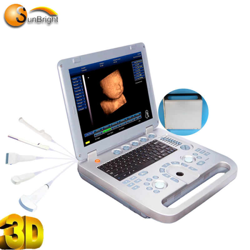 High resolution Imaging Cheap 3D 4D ultrasound machine for pregnancy