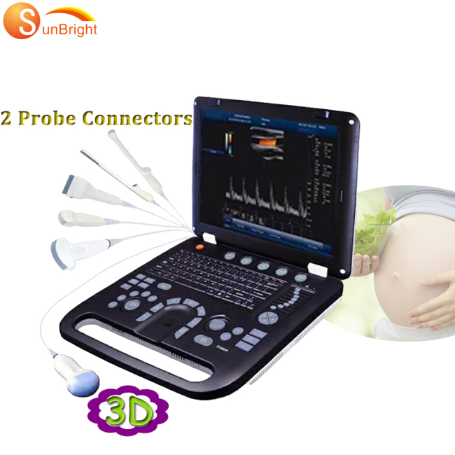 128 elements medical home use ultrasound cheap scanning machine 3d with convex probe