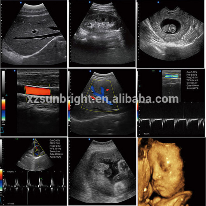 high performance full digital ecograph laptop notebook portable color doppler ultrasound