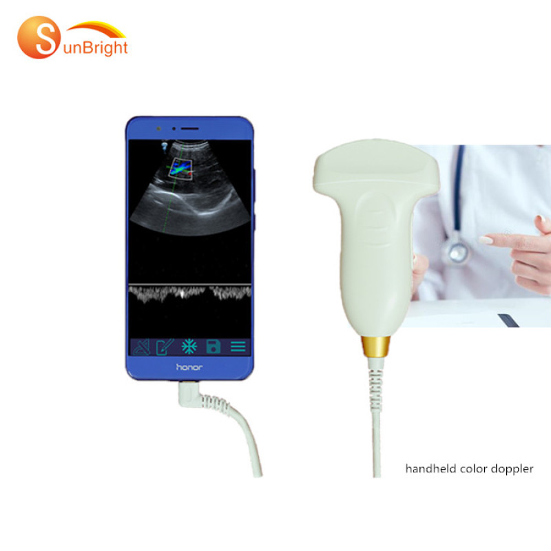 Hot Sale Portable Color Doppler usb android wireless ultrasound probe convex