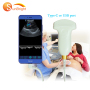 high resolution USB probe portable color ultrasound low price