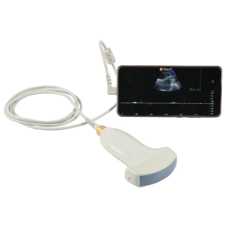 factory price portable USB probes ultrasound color doppler probe