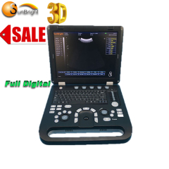 Win7 Laptop China Medical Digital 3D Cheapest Portable Ultrasound Machine for sale
