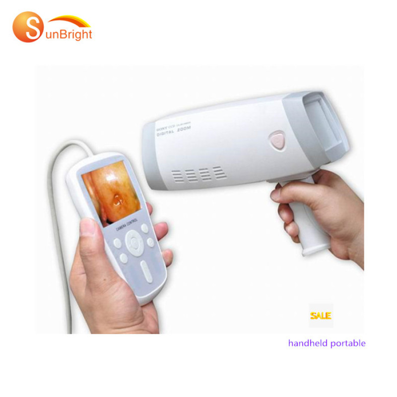 Equipo de máquina de colposcopio video cervical electrónico portátil anormal vaginal