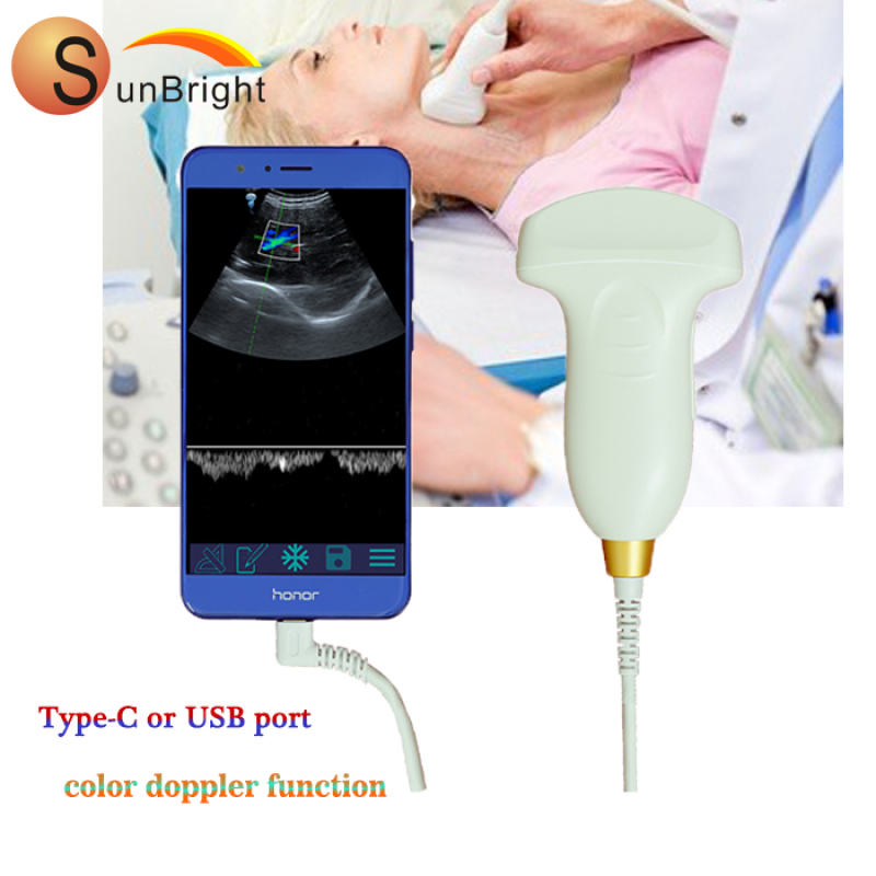 휴대용 초음파 C형 무선 볼록 프로브