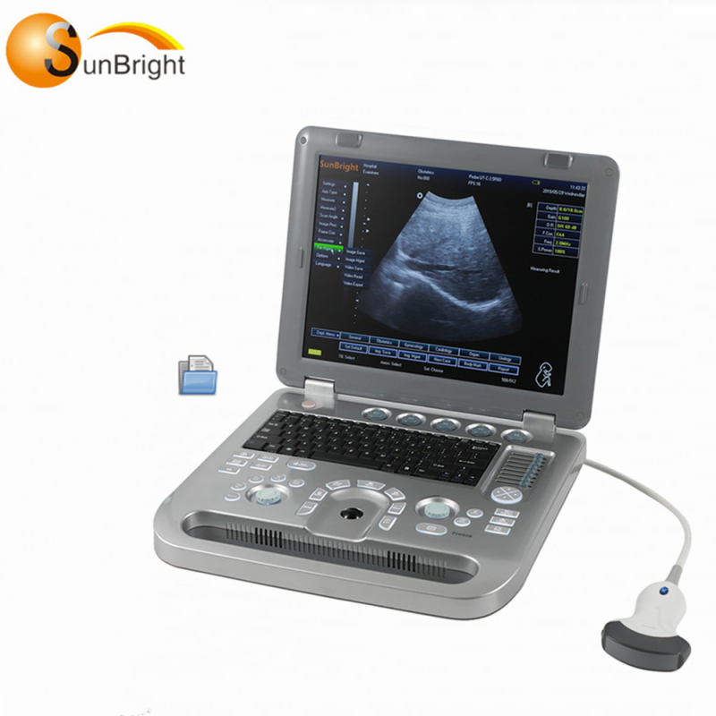High quality market confirmed 3D ultrasound sun-800d