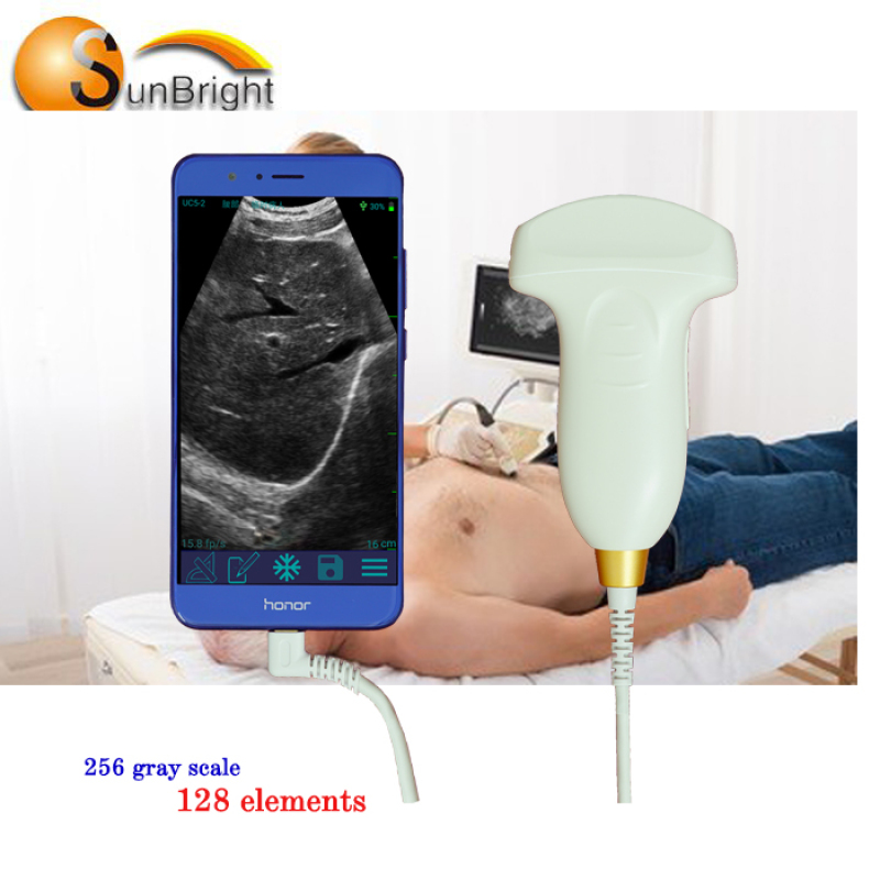 iphone connect high digital portable handheld ultrasound probe equipment