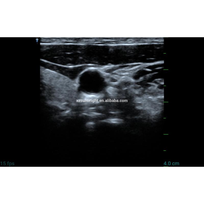 New Product USB&WiFi Ultrasound Linear Probe For Android/Windows Device cheapest ultrasound probe