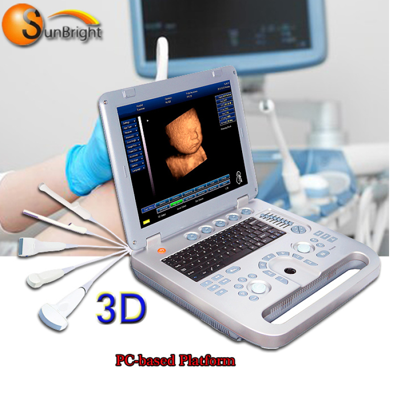 Popular ultrasound portable home Machine Model Scanner With Convex Probe