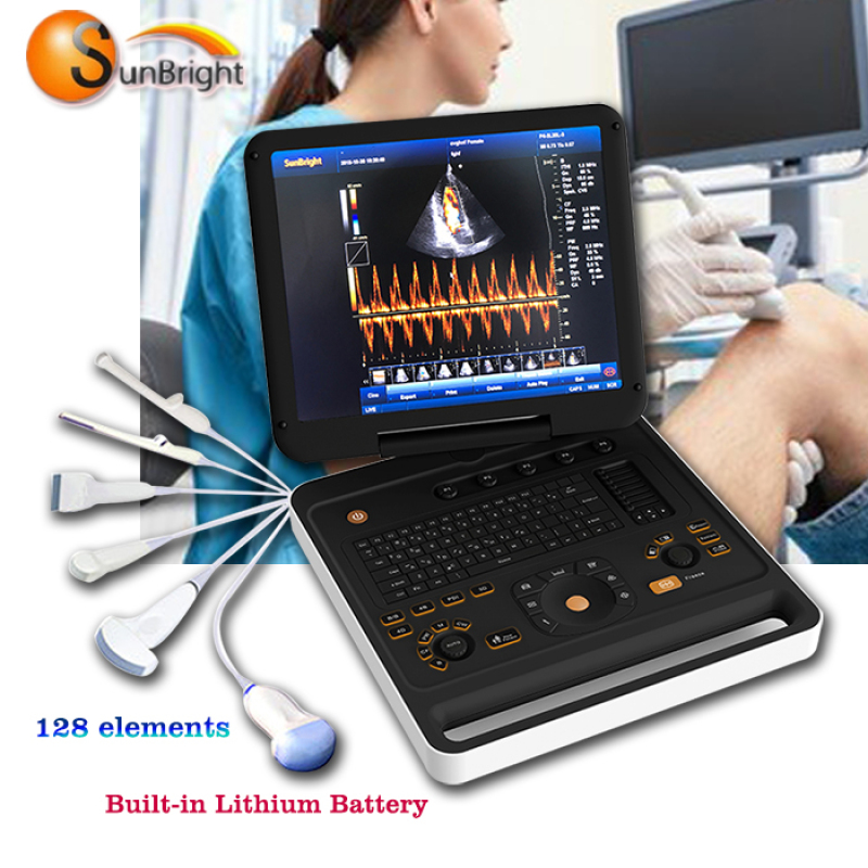 عالية الأداء الساخن بيع الطبية المحمولة 3D4D اللون دوبلر ecografos دي الصين سعر المصنع