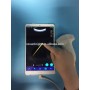 High resolution SUN-P1 medical portable 2D USB probe sonography machine portable ultrasound android