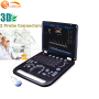 128 elements 3D medical THI ultrasound machine for sale with convex probe