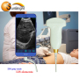 factory price medical portable iphone connect usb probes ultrasound for sale
