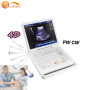Factory price newest ultrasound better than intellivue mx40 3D ultrasound