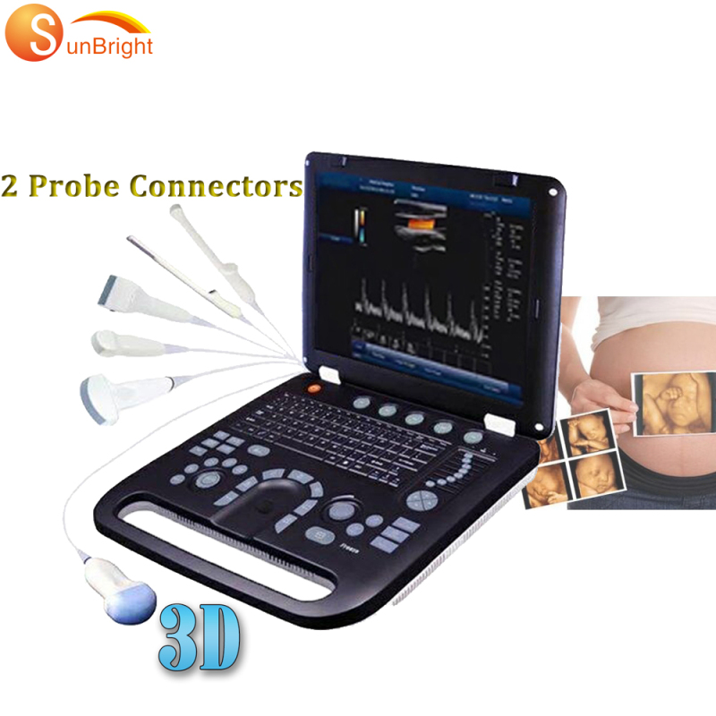 Portable medical diagnostic laptop color doppler 3D 4D ultrasound scanner machine
