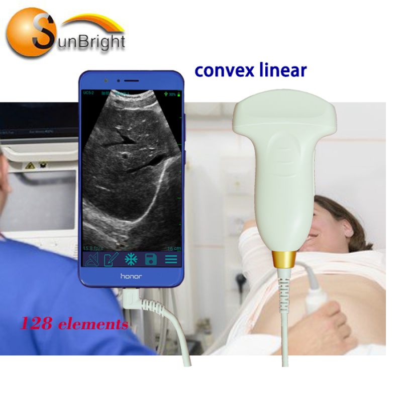 Best Usb Wifi 128E vascular ultrasound wireless Probe/Scanner/Transducer In Xuzhou
