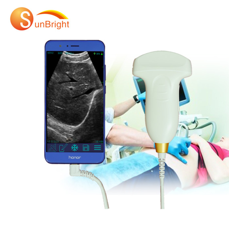 high intensity medical diagnostic handheld convex probe ultrasound scanner portable usb connected