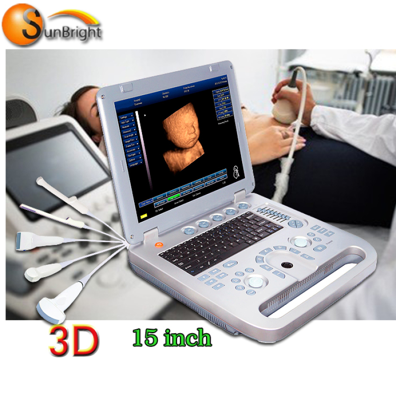 Heißer verkauf 15 zoll LED gute qualität 3D ultraschall maschine scanner