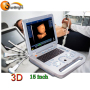 Heißer verkauf 15 zoll LED gute qualität 3D ultraschall maschine scanner