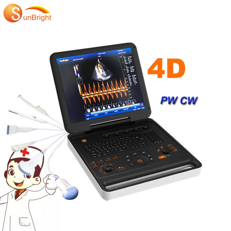 Просунуті багато людей купують портативний ультразвуковий бездротовий 4D ультразвуковий сканер