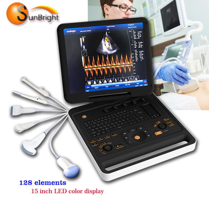 high digital portable ultrasound scanner wireless probe ultrasonic diagnostic equipment