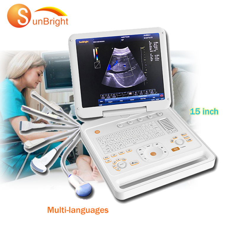 SUN-906A Подібний кольоровий доплерівський ветеринарний ультразвуковий апарат високої якості Sonoscape