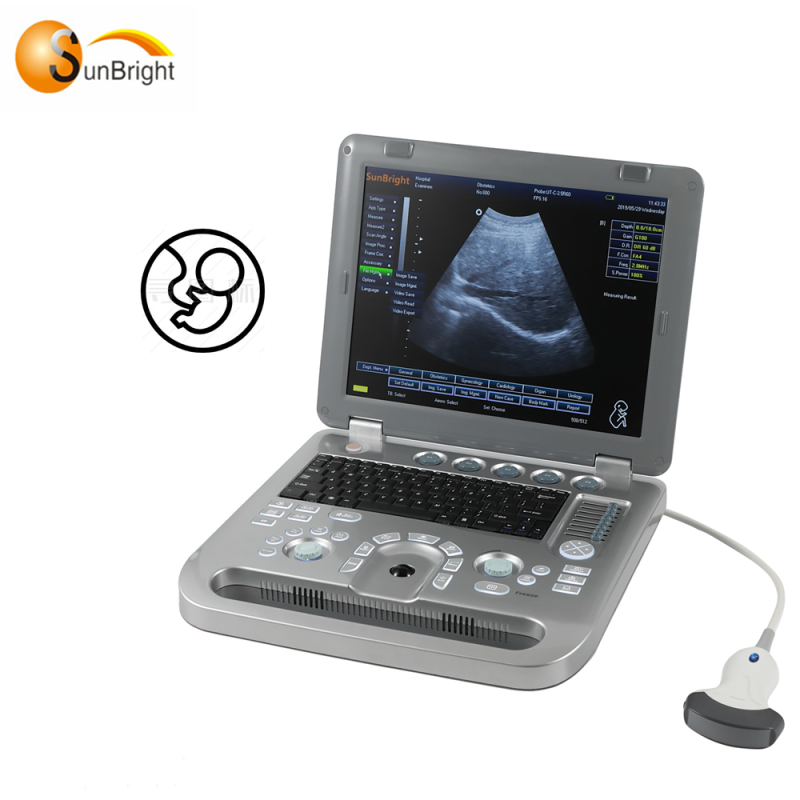 Portable Human Used Digital Scanner Portable 3D Ultrasound Machine With Pseudo Color