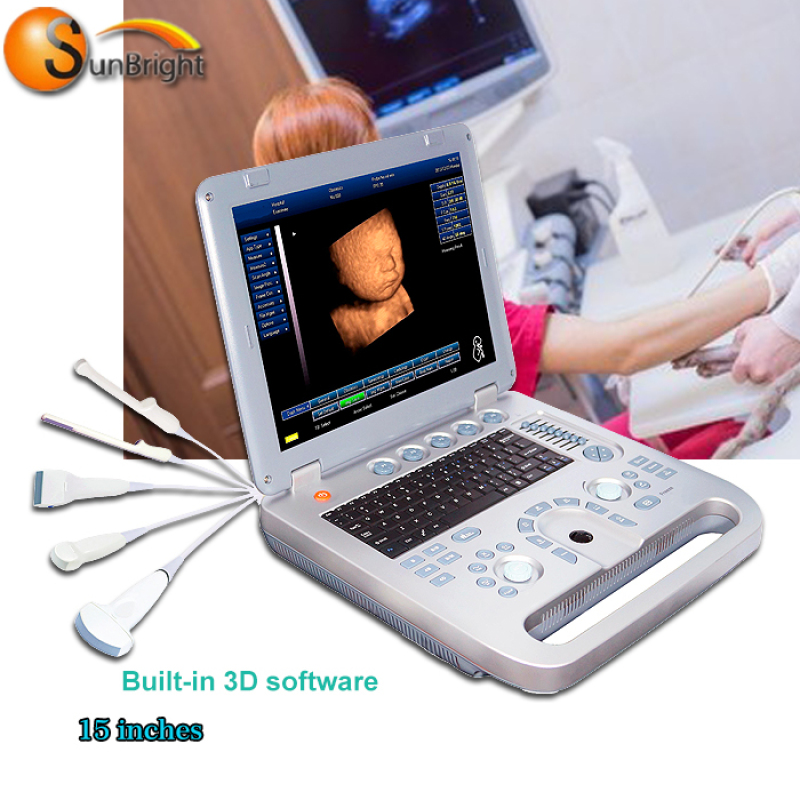 Bestselling High Quality 3D 4D Laptop Color Ultrasound 3D Ultrasound Laptop And Probe SUN-800D