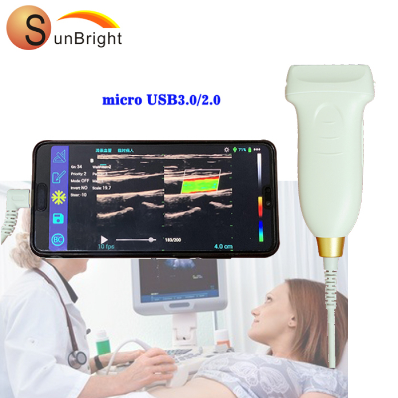 High frequency color doppler probe 14mhz wireless USB linear usb ultrasound probe price wireless