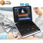 Hospital 3D color carotid doppler ultrasound machine