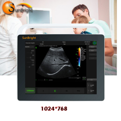video printer ultrasound High quality Portable Color VET Ultrasound System