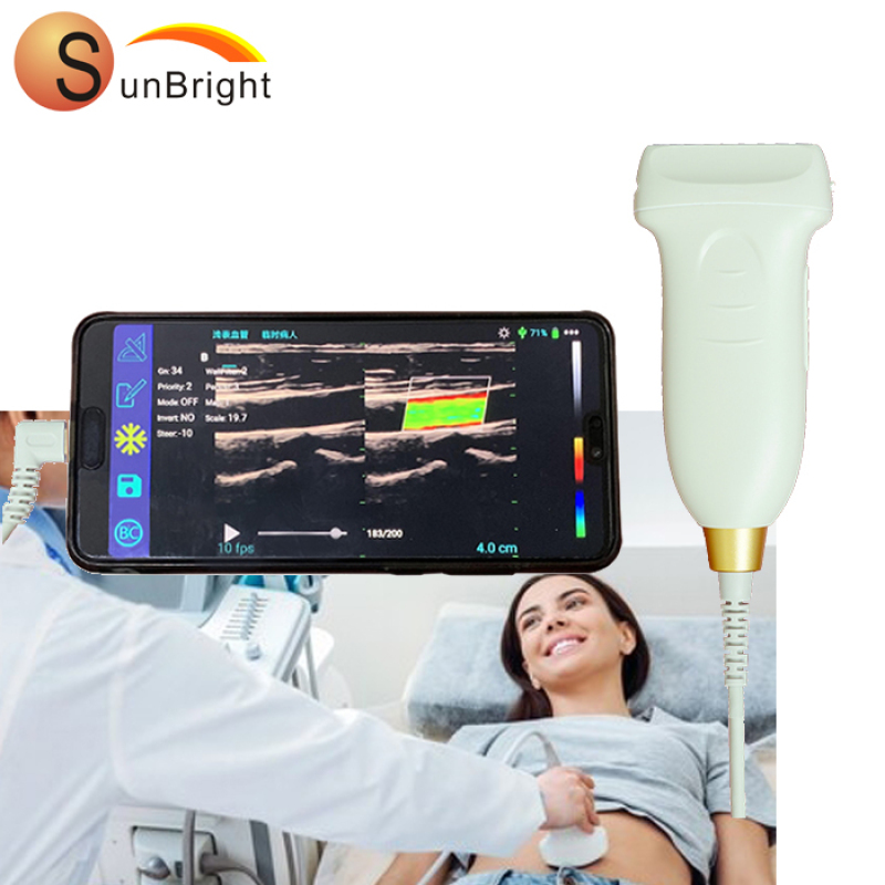 High Resolution Pocket Color Ultrasound Device USB Probe on sale