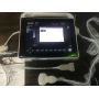 buy VET 15 inch laptop touch screen ultrasound machines convex probe